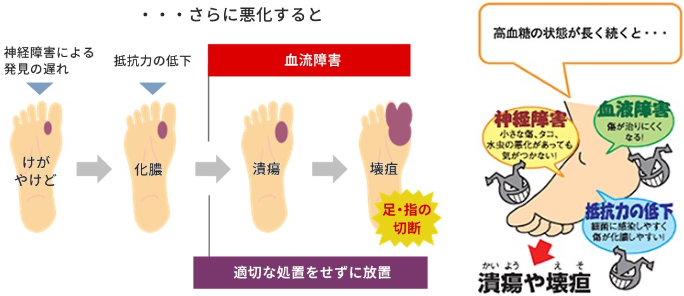 ・・・さらに悪化すると